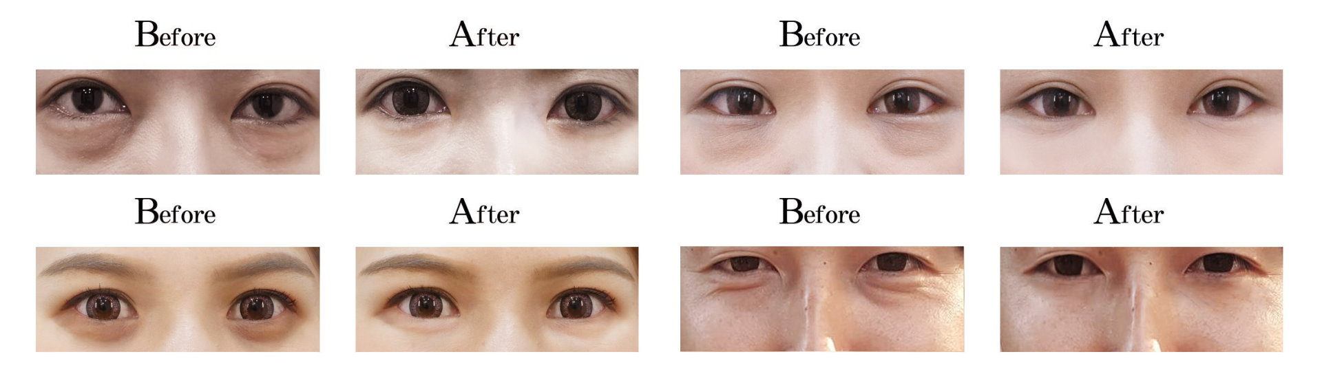 台南雷射汽化手術推薦醫師診所