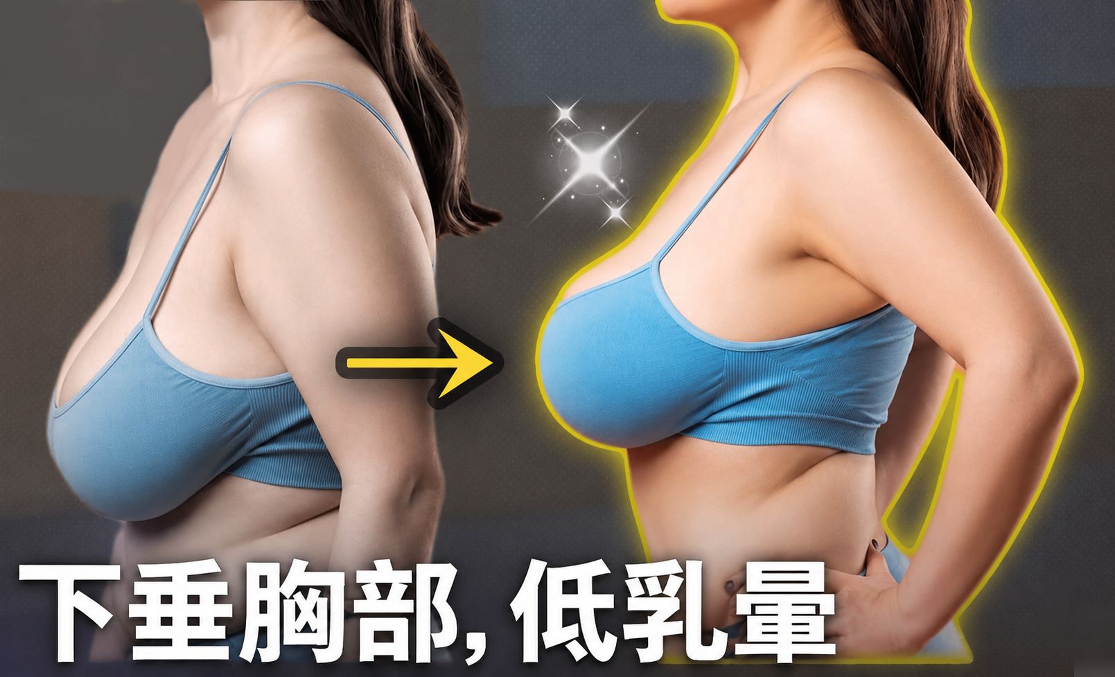 台南提乳手術權威醫師推薦價格費用