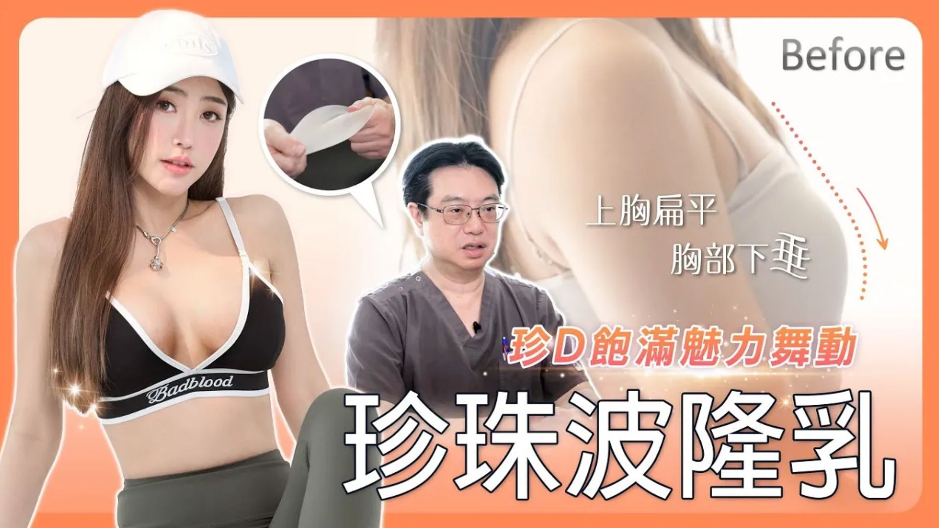 台南珍珠波盈波隆乳權威醫師推薦邱智弘價格費用002
