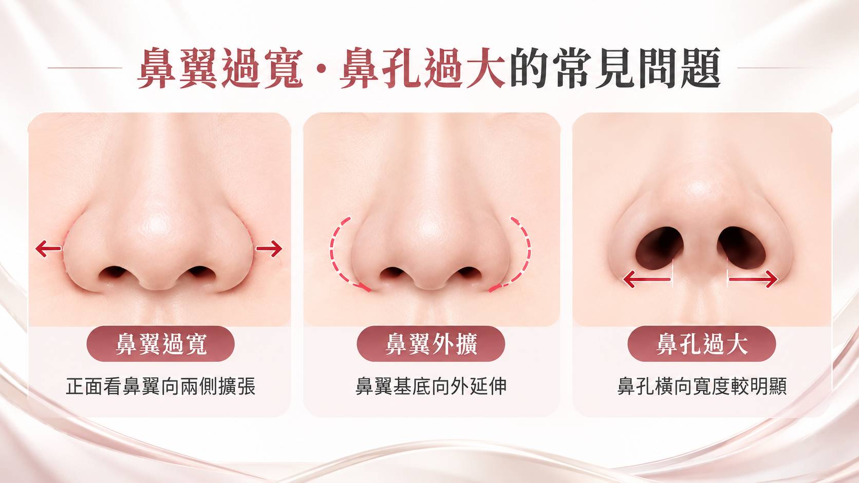 台南縮鼻翼縮鼻孔手術權威醫師推薦價格費用多少005