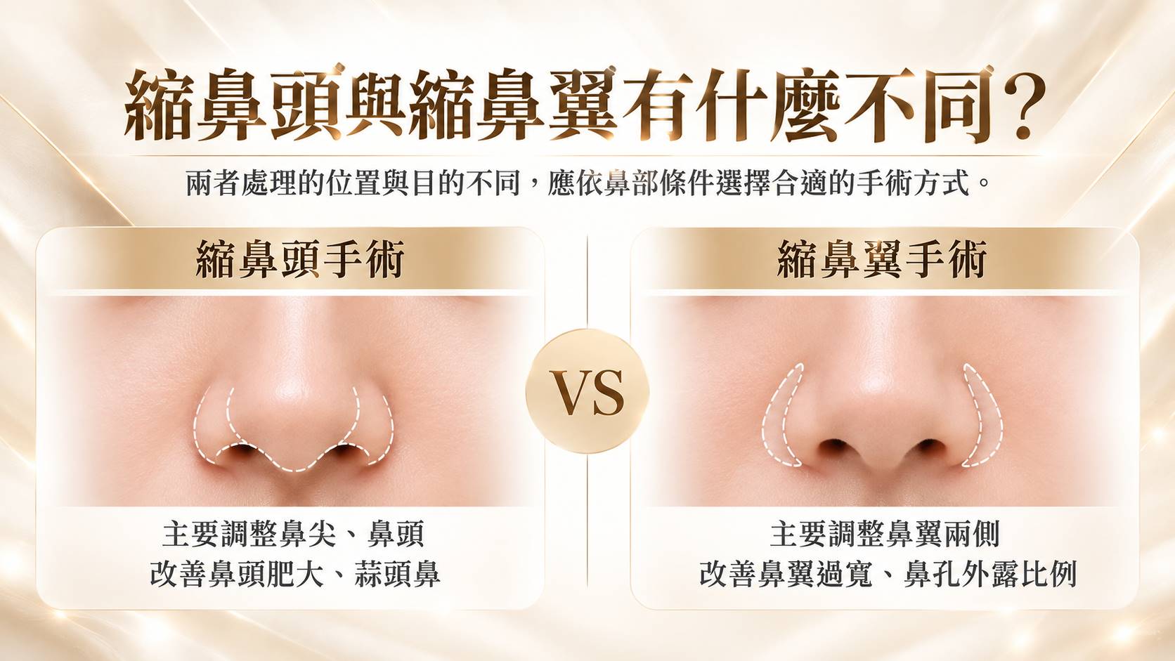 台南鼻頭塑型縮鼻頭手術權威醫師推薦價格費用介紹005