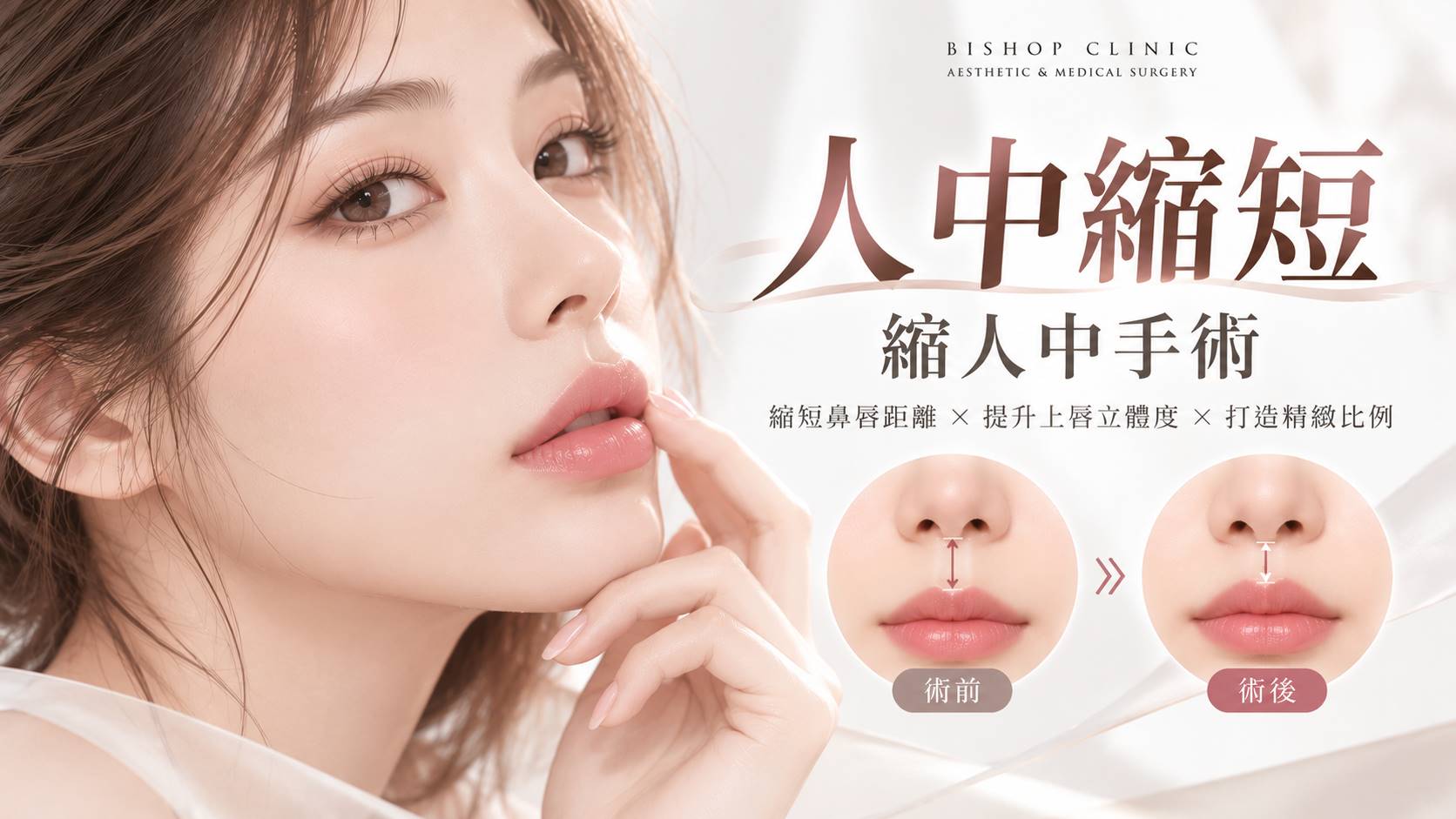 台南縮人中縮短手術權威醫師推薦價格費用介紹006