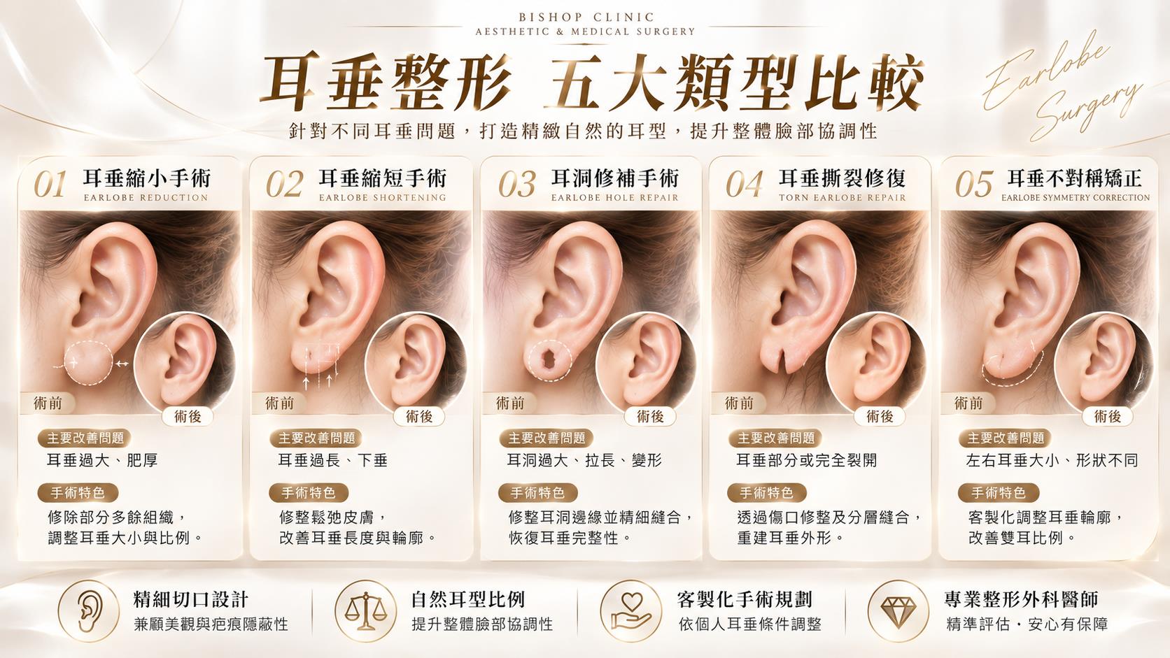 台南耳垂整形手術權威醫師推薦價格費用多少004